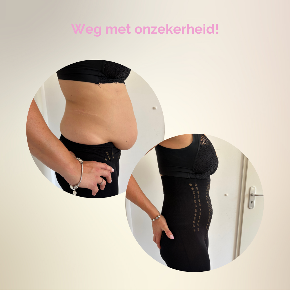 SlimBodyPro™ | Corrigerend ondergoed | 1+1 GRATIS